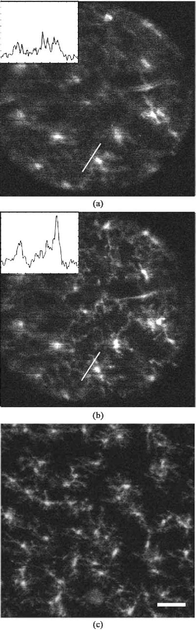 Figure From In Vivo Fluorescent Imaging Of The Mouse Retina Using