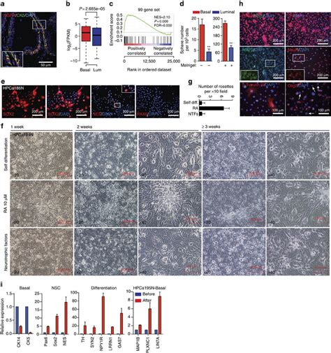 Intrinsic Proneural Properties Of Human Prostate Basal Epithelial