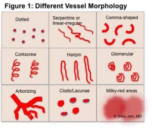 Practical Dermoscopy: Part 2 - Next Steps in Dermatology