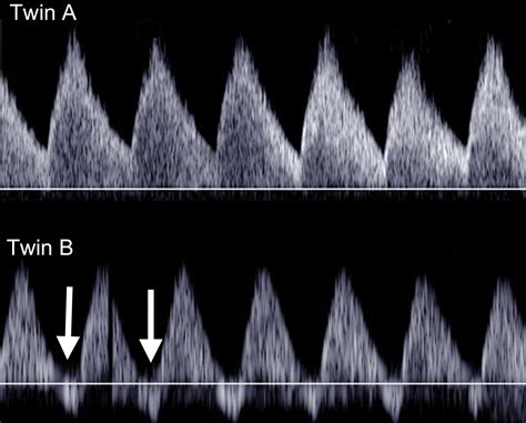 A Radiologists Guide To The Performance And Interpretation Of