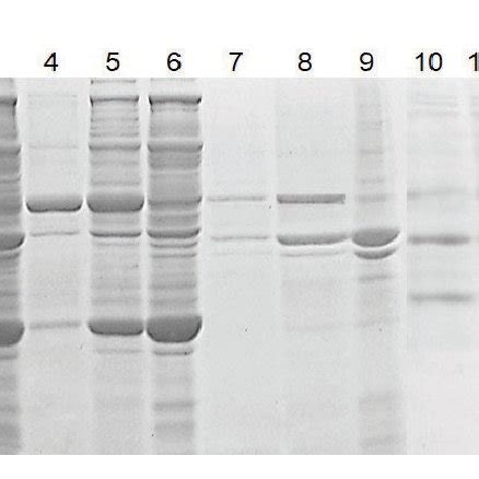 Coomassie Brilliant Blue Stained Sds Page Showing Tk In