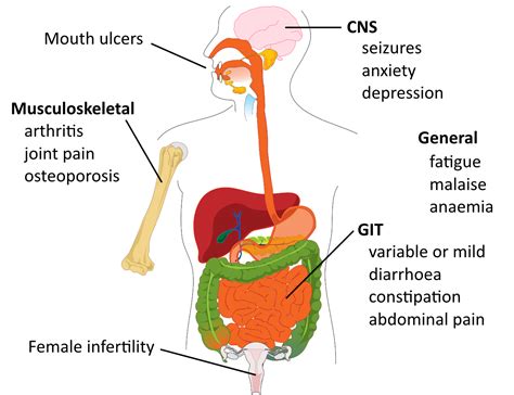 Coeliac Disease Overpath