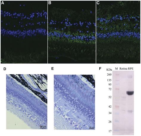 Localization Of Rpe65 In The Lamprey Rperetina Cy3 Green Staining