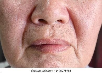 Aging Skin Folds Skin Creases Wrinkles Stock Photo 1496275985