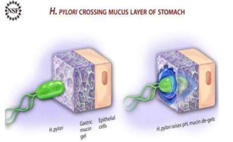 Bacterial Infections Flashcards Quizlet