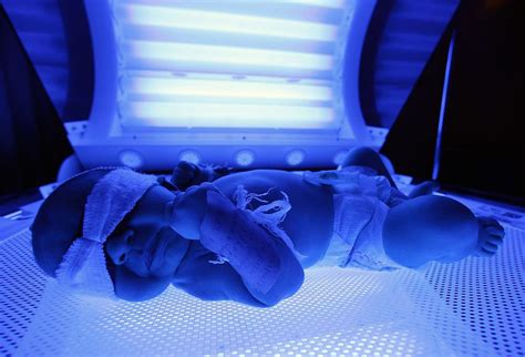 Light Therapy For Neonatal Jaundice Photograph By Science Photo Library