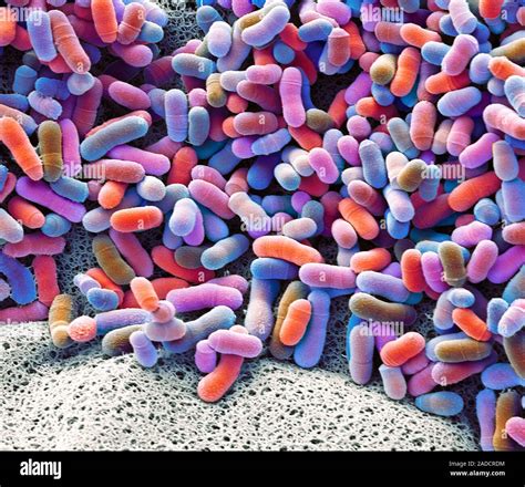 Bacteria From A Human Armpit Coloured Scanning Electron Micrograph