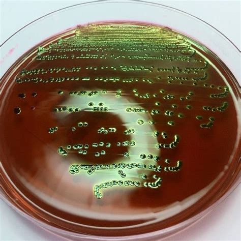 Microbio On Twitter Escherichia Coli