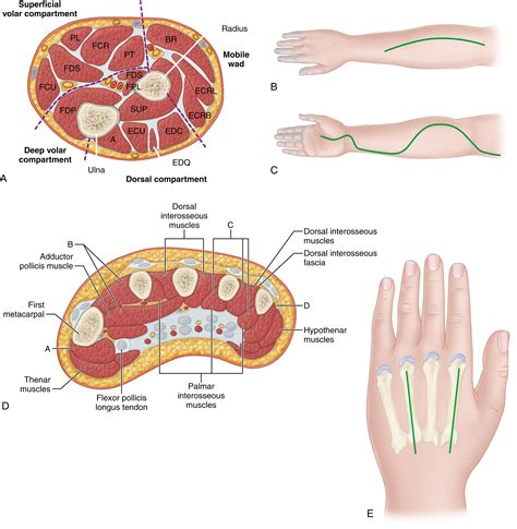 Compartment Syndrome In The Extremities Clinical Tree