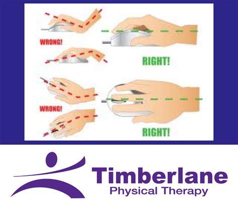 Carpal tunnel syndrome - Timberlane Physical Therapy