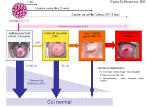 Dépistage du cancer du col de l utérus entre 25 et 65 ans êtes vous