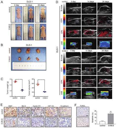 Inhibitory Effect Of CVB D On DLD 1 Xenografts In BALB C Nude Mice