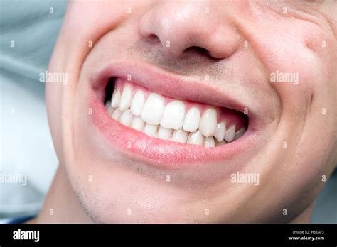 The Features Of A Perfect Smile Orlando Smiles Inc 5 Reasons Pretty