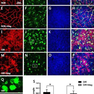 Magnolol Reduces Gfap Expression In M Ller Cells And Down Regulates