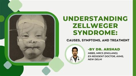 Understanding Zellweger Syndrome Causes Symptoms Etc