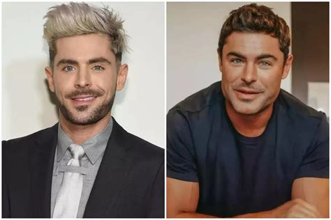 Zac Efron Explica Por Fin Lo Que Le Pasó En La Cara