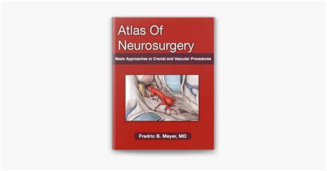 ‎atlas Of Neurosurgery Basic Approaches To Cranial And Vascular