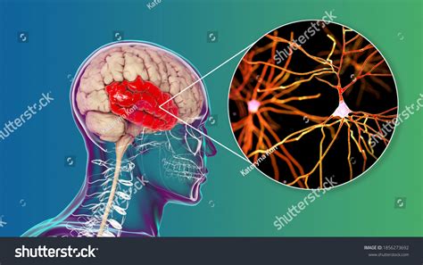 Human Brain Highlighted Temporal Lobe Closeup Stock Illustration