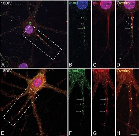 Figure 1 from Colocalization of α actinin and synaptopodin in the