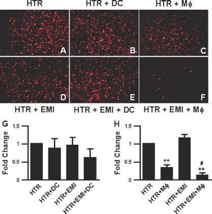 Invasion Assays Of Htr Svneo Cells Co Cultured With Dendritic Cell