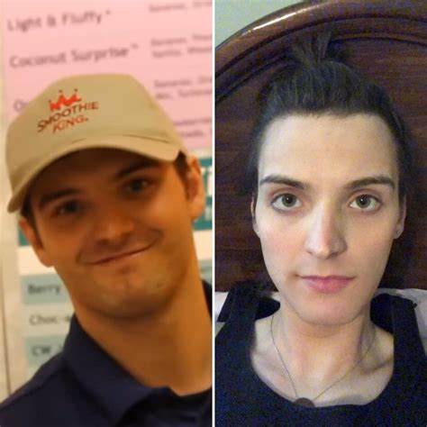 9.5 Months HRT!! 💕 loveeee hormones! : r/transtimelines