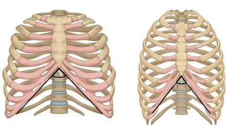 Infrasternal Angle: What it is and why its important — Rosa Performance ...