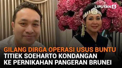 Gilang Dirga Operasi Usus Buntu Titiek Soeharto Kondangan Ke