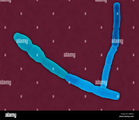 Color Análisis Micrografía De Electrones Sem De Bacillus Cereus Gram
