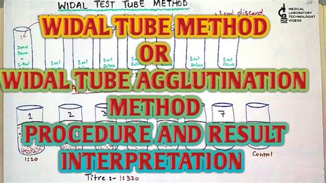 Widal Test Tube Or Tube Agglutination Or Tube Titration Methodprocedure And Result