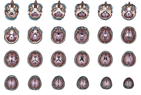 Human Brain Anatomy Photograph By Zephyr Science Photo Library Pixels