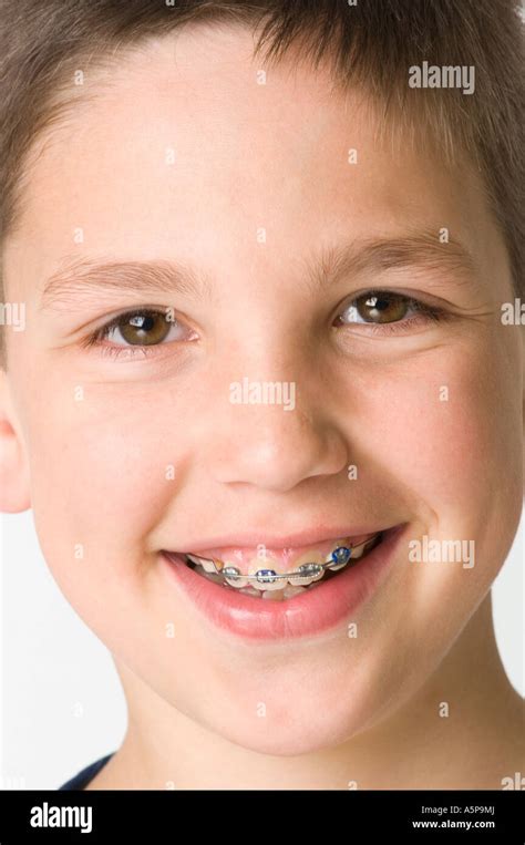 Boy With Braces Smiling At Camera Stock Photo Alamy