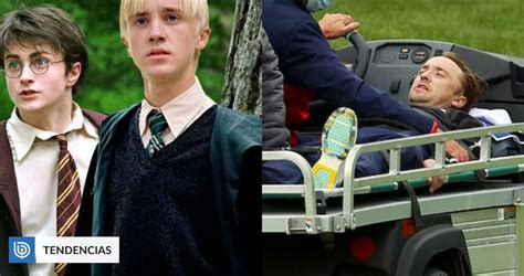 Tom Felton actor detrás de Draco Malfoy sufrió un colapso mientras