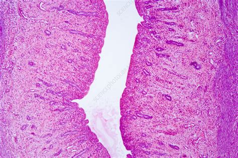 Cross Section Of Human Vagina Lm Stock Image C Science