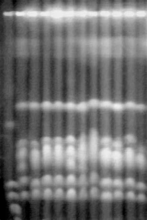 The Pulsed Field Electrophoresis Of The Chromosomal DNA Of L Kluyveri