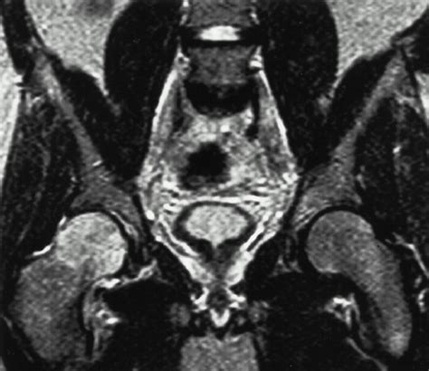 Adult Chronic Hip Pain Radiographic Evaluation Radiographics