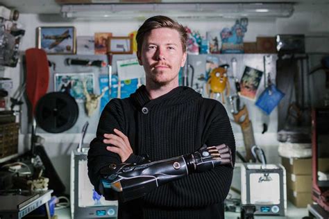 Hero Arm D Printed Bionic Arm Gives Below Arm Amputees A New Hope