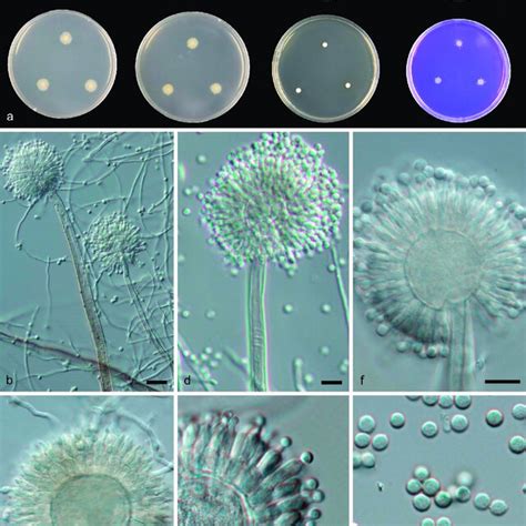 aspergillus guangxiensis cgmcc    colonies top row left