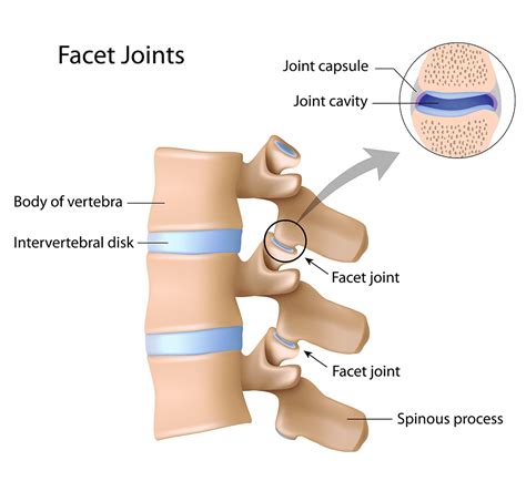 Facet Joint Injections Albuquerque Nm Modern Pain Spine