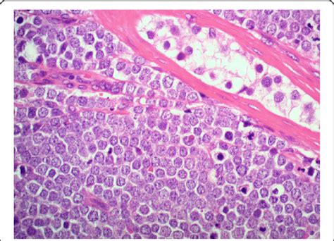 High Power Image Hematoxylin And Eosin Stain Original Magnification