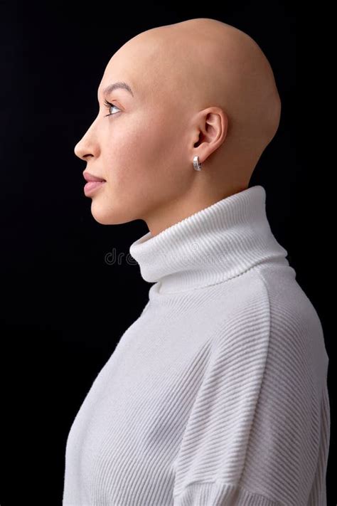 Side View Portrait Of Confident Hairless Young Caucasian Woman With