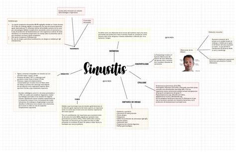 Sinusitis Eve Meds Udocz