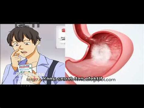 IKLAN POLYSILANE JURUSJITU 15s 2020 YouTube