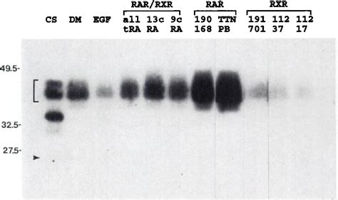 Figure 1 From Retinoid X Receptor Specific Retinoids Inhibit The