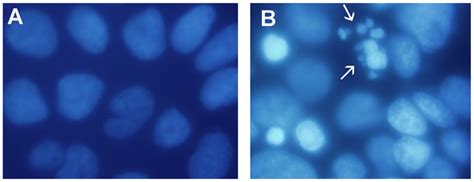 Epifluorescent Micrographs Showing Hoechst Staining Of Dna In Caco