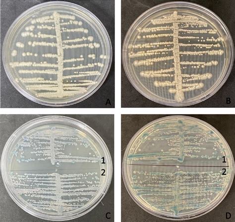 A And B Growths Observed In Sabouraud Dextrose Agar Incubated At 30o C