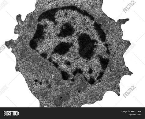 Transmission Electron Microscope Images