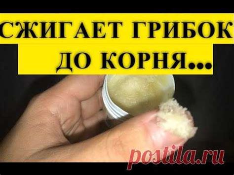 Эта ЯДРЕНАЯ Мазь, Съедает Ногтевой Грибок До Самого Корня! Есть в Любо ...