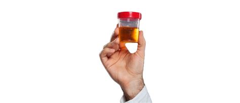 Dark Yellow Urine: Causes, Treatment, & How to Prevent? | OMNI Hospitals