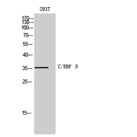 Anti Cebp Beta Cebpb Antibody Rabbit Anti Human Polyclonal Lsbio