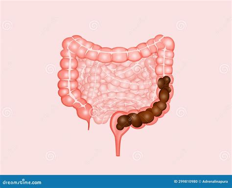 Illustration Of The Intestine With Feces Stock Illustration